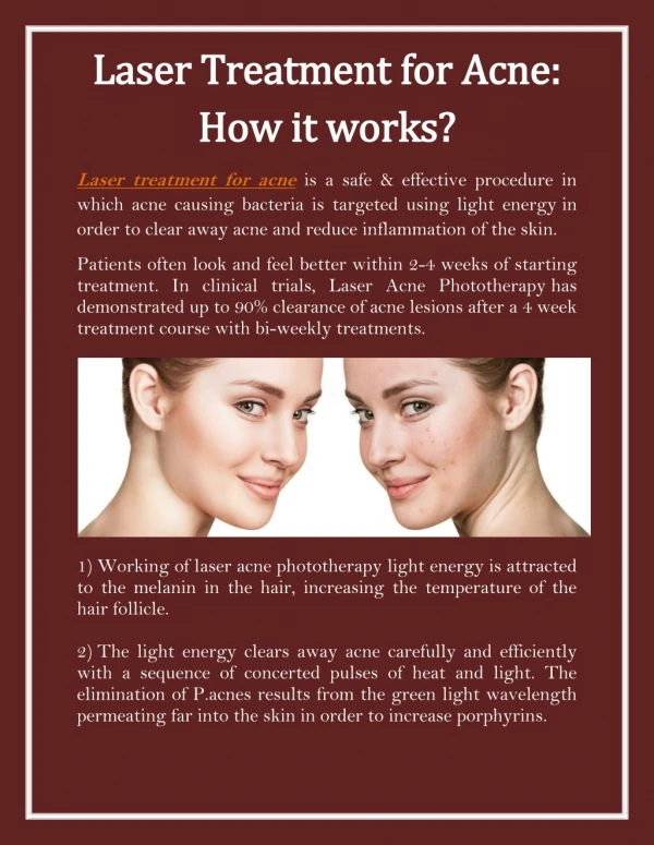 Laser Treatment for Acne: How it works?