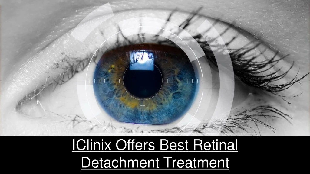 iclinix offers best retinal detachment treatment