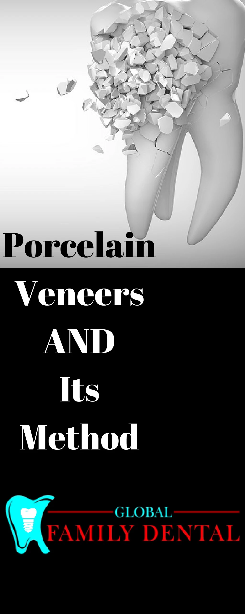 porcelain veneers and its method
