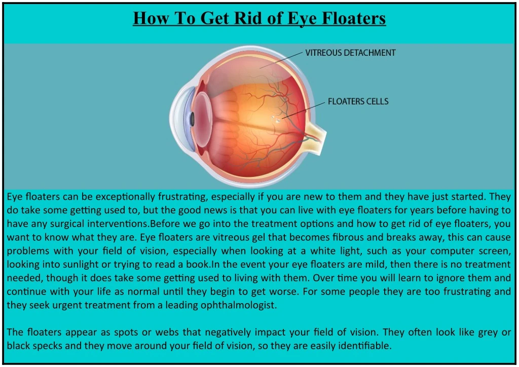 how to get rid of eye floaters