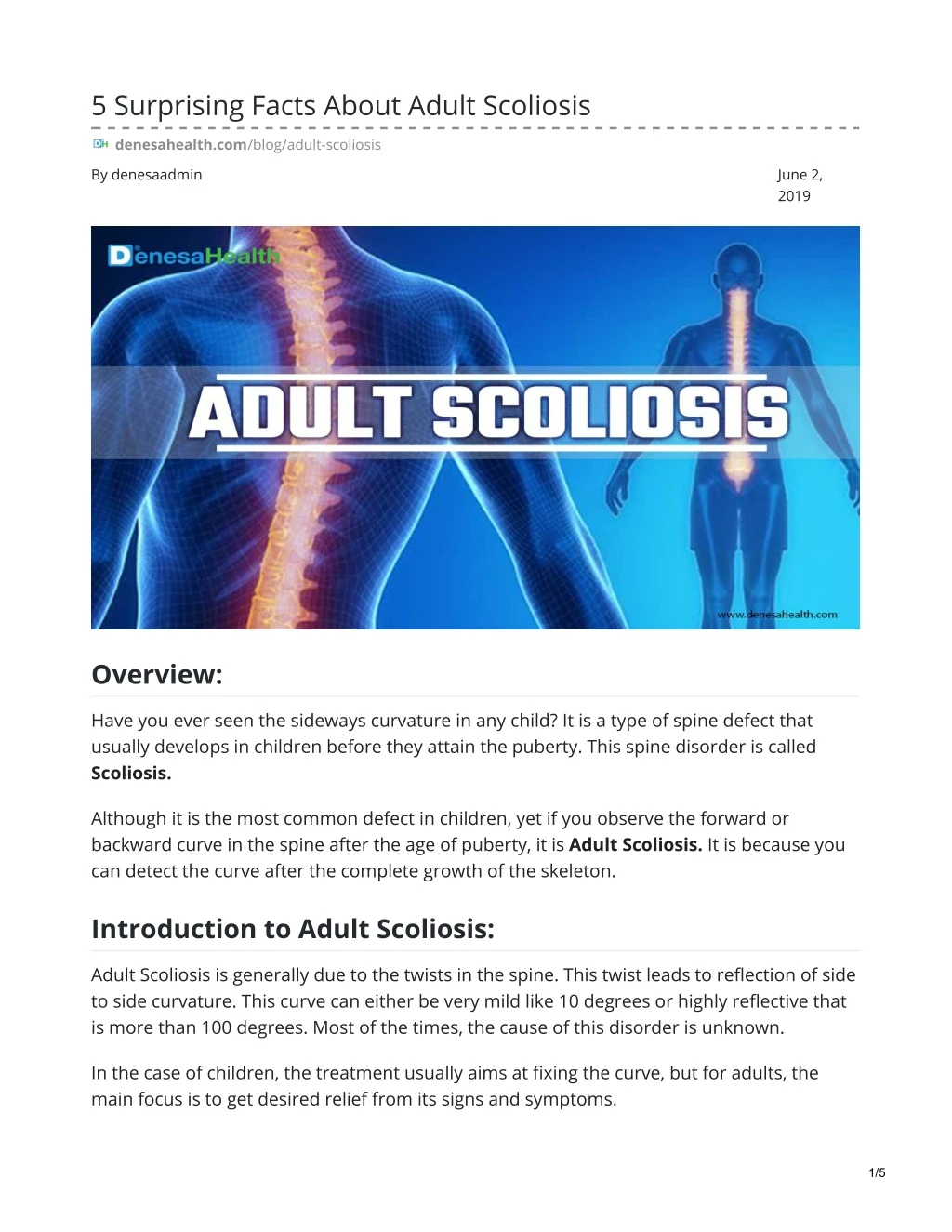 5 surprising facts about adult scoliosis