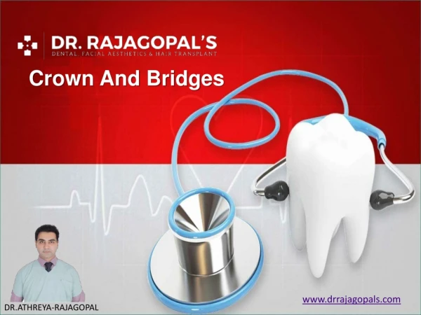 Dental Crown And Bridges - Dr. RajaGopal's Clinic
