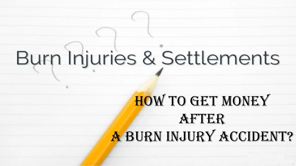 how to get money after a burn injury accident
