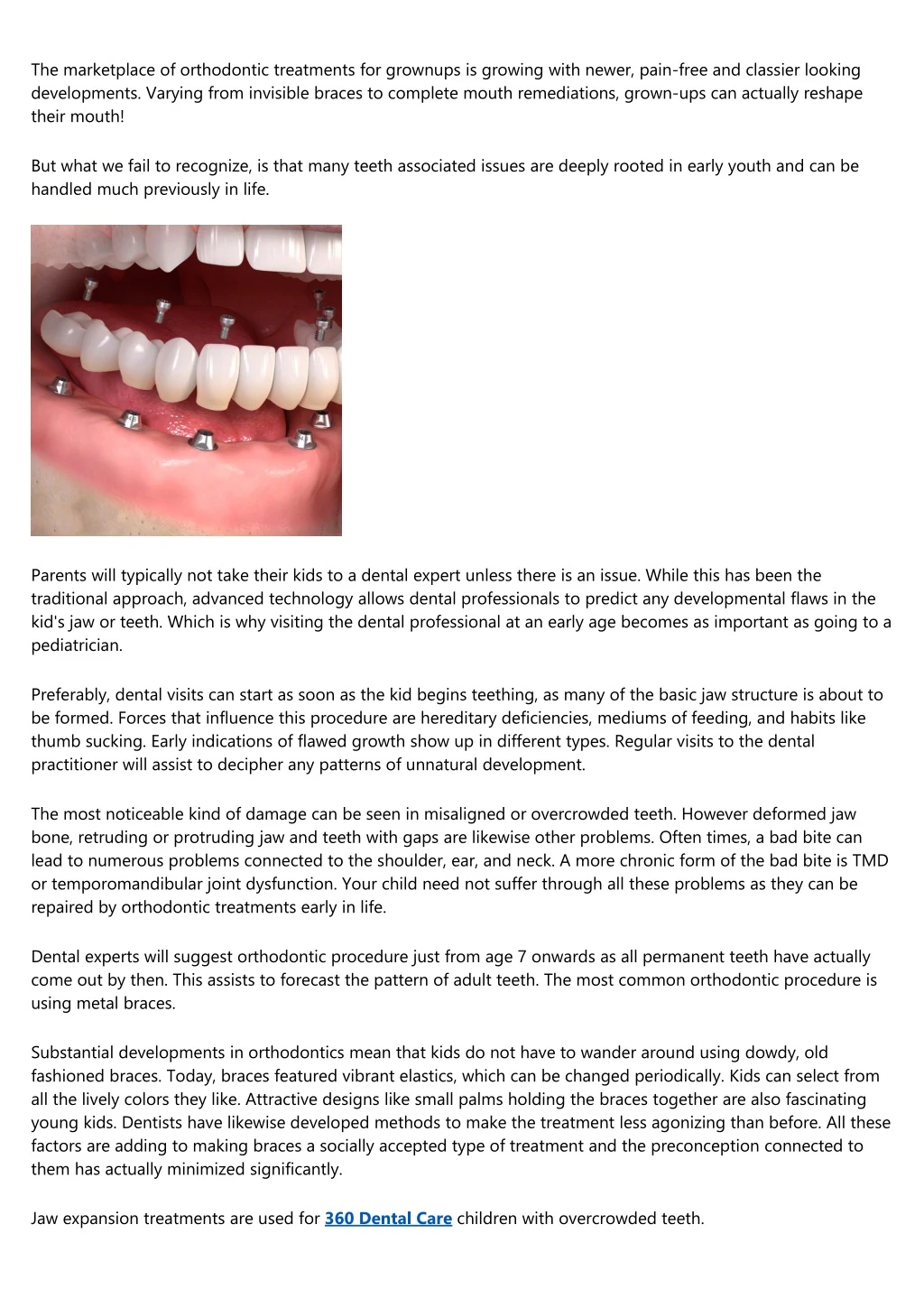 the marketplace of orthodontic treatments