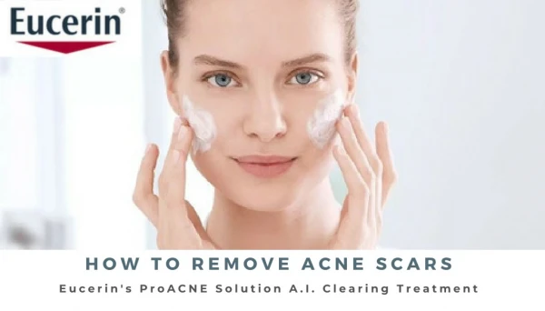 How to remove acne scars-acne treatment malaysia