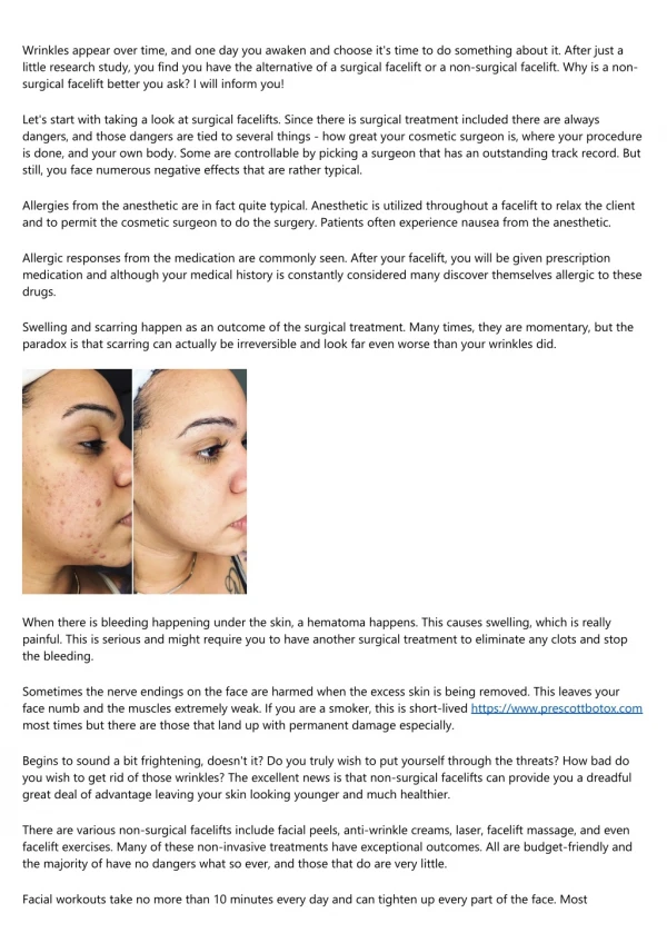 Non-Surgical Face Lift - Why is it Better Than Surgery?