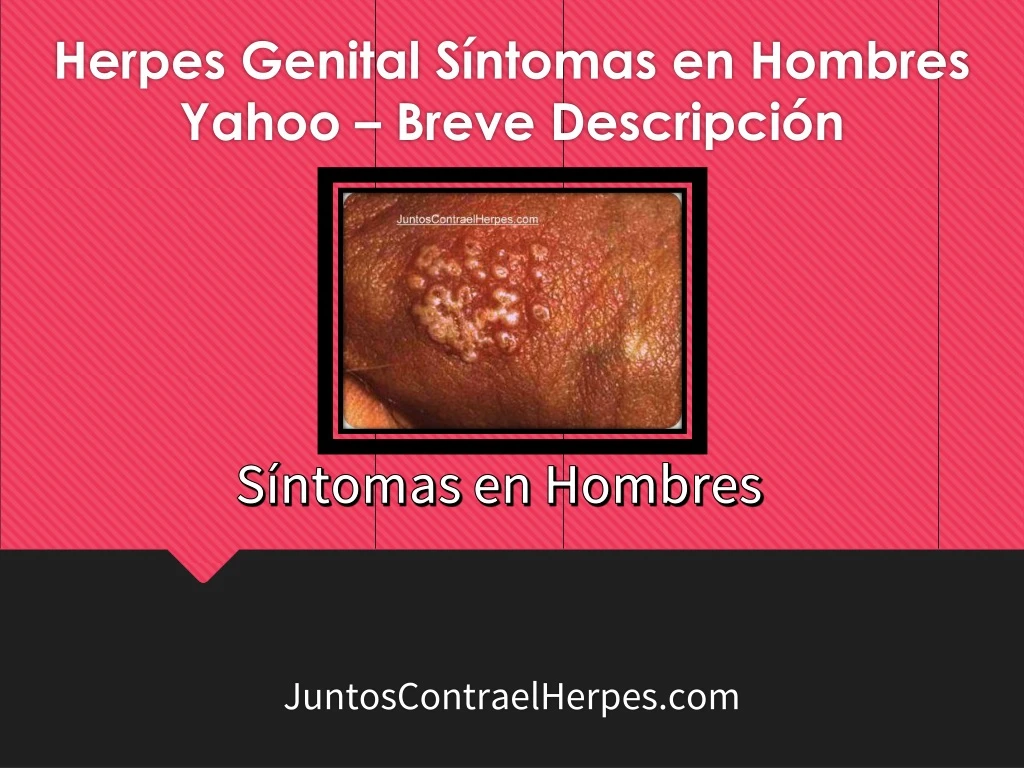 herpes genital s ntomas en hombres yahoo breve descripci n