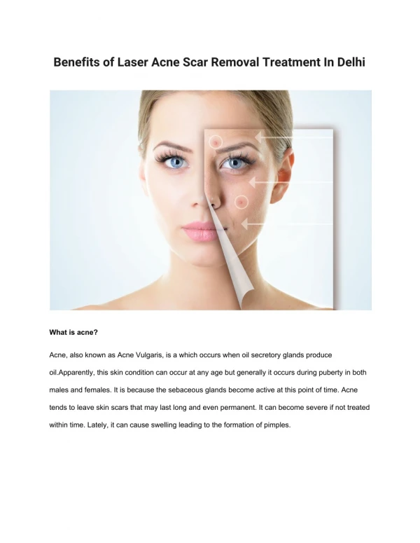 Benefits of Laser Acne Scar Removal Treatment In Delhi
