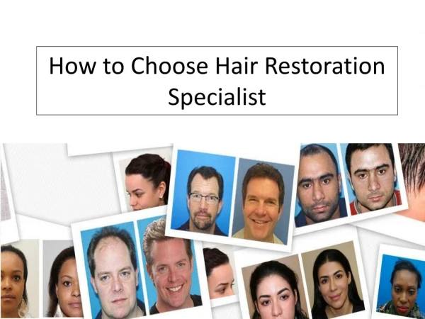 How to Choose Hair Restoration Specialist