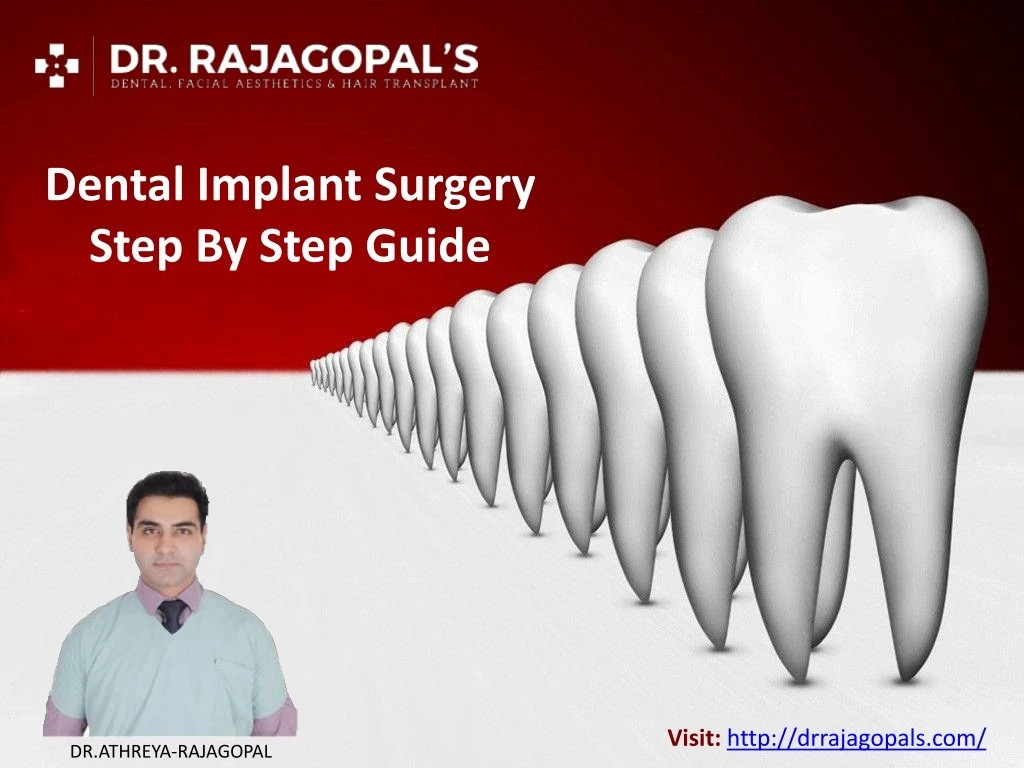 dental implant surgery step by step guide