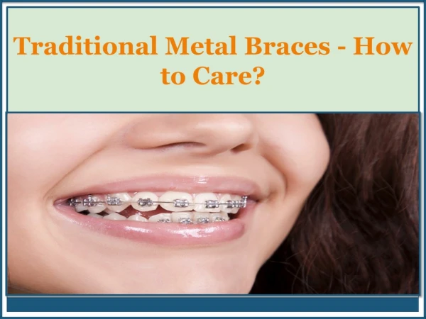 Traditional Metal Braces - How to Care?