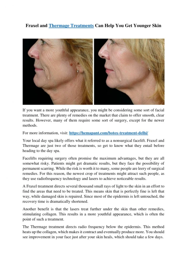 Fraxel and Thermage Treatments Can Help You Get Younger Skin