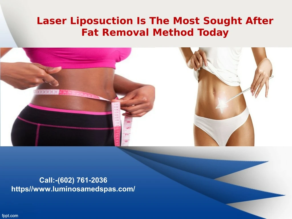 laser liposuction is the most sought after