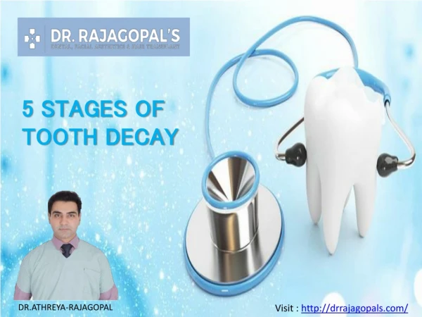 5 Stages of Tooth Decay - Dr. RajaGopal's Clinic.