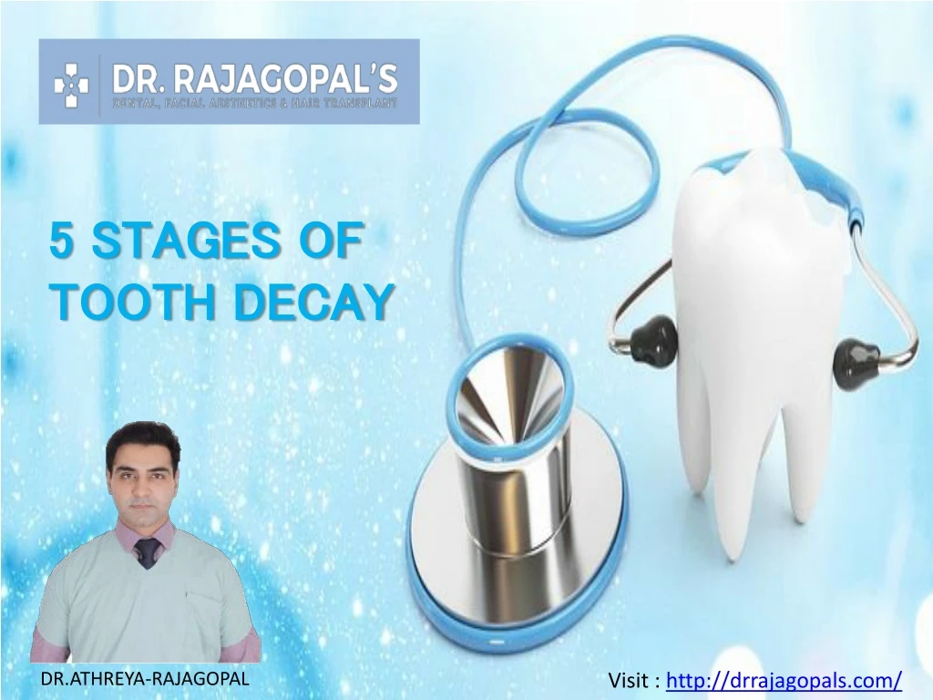 5 stages of tooth decay