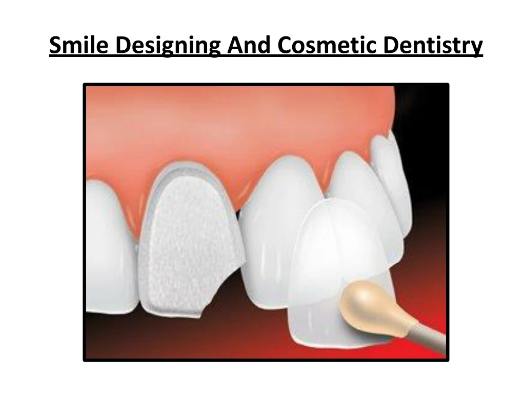 smile designing and cosmetic dentistry