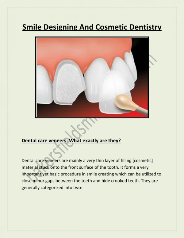 Smile Designing and Cosmetic Dentistry