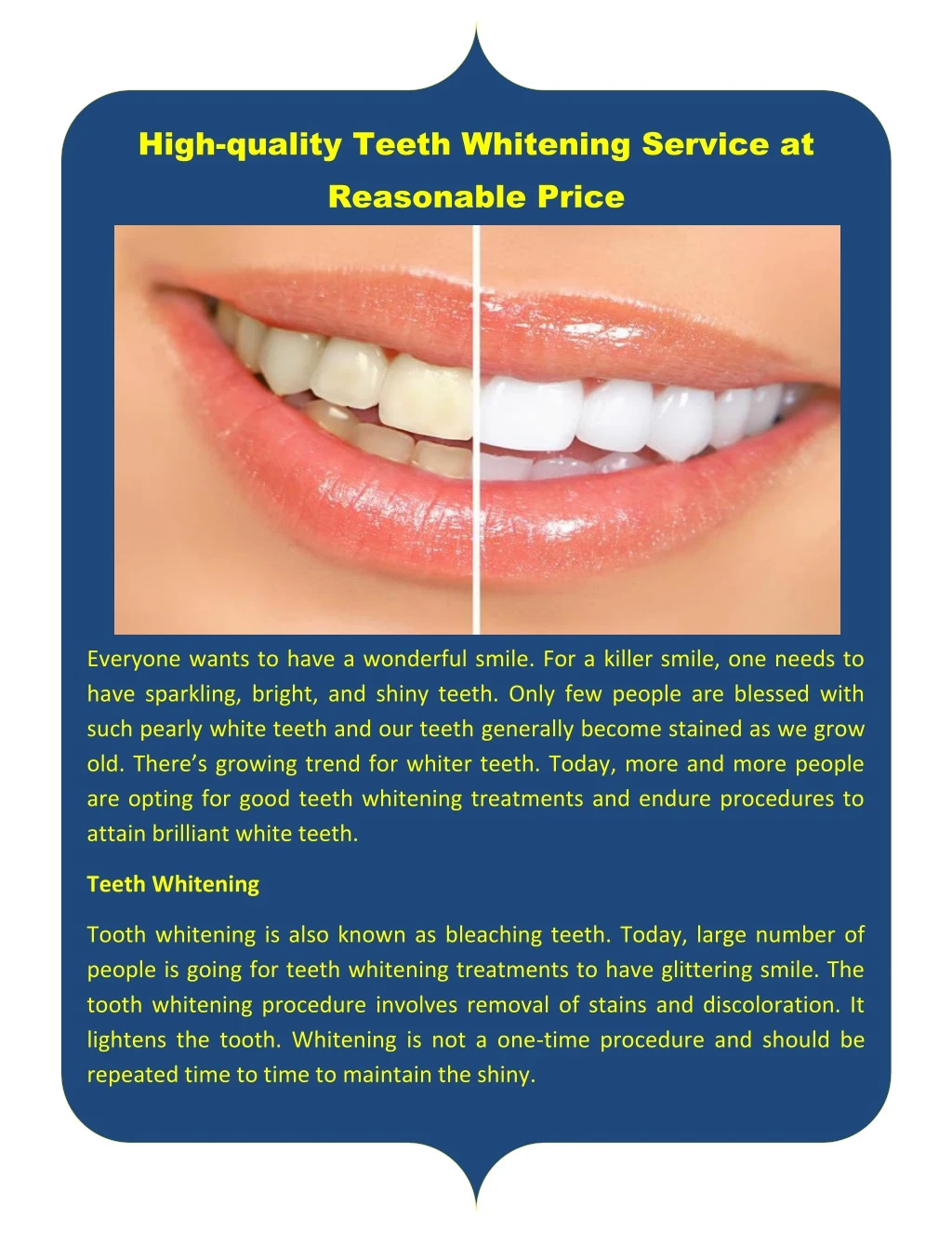 high quality teeth whitening service