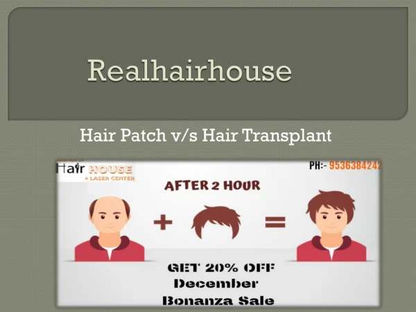 Hair Patch in Delhi | Hair Bonding in Delhi : 91-9536384242