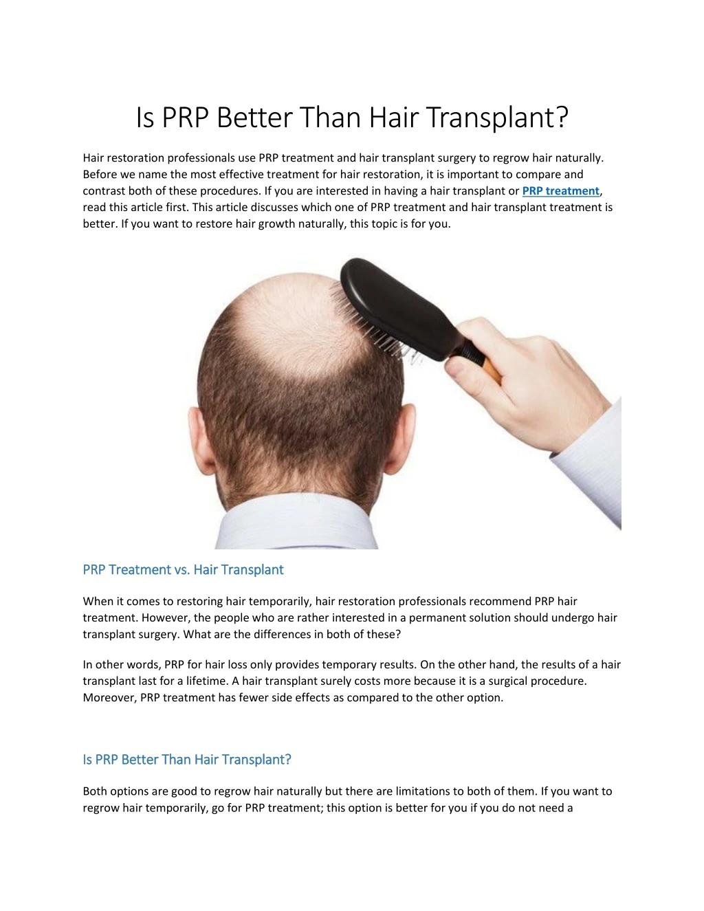 is prp better than hair transplant