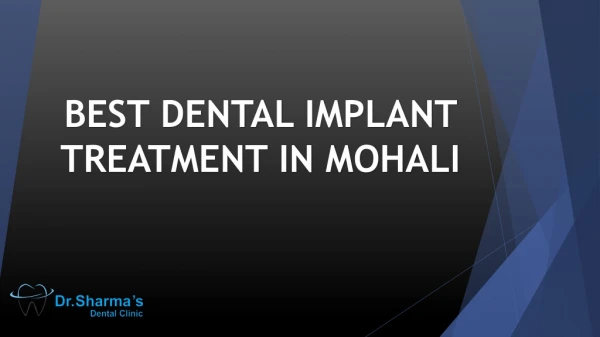 Best Dental Implant Treatment in Mohali