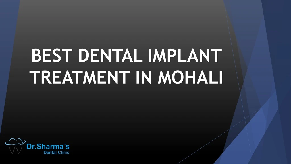 best dental implant treatment in mohali