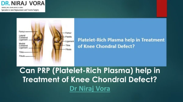 Platelet rich plasma help in treatment of knee chondral defect by dr. niraj vora