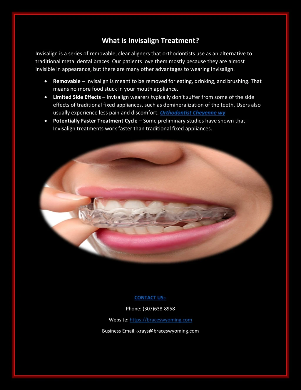 what is invisalign treatment