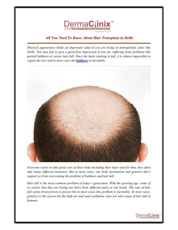 All You Need To Know About Hair Transplant in Delhi