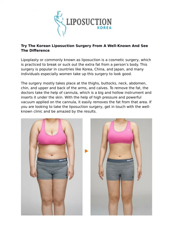 Try The Korean Liposuction Surgery From A Well-Known And See The Difference