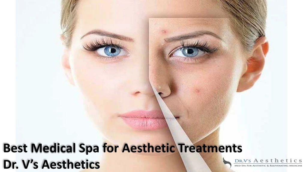 best medical spa for aesthetic treatments
