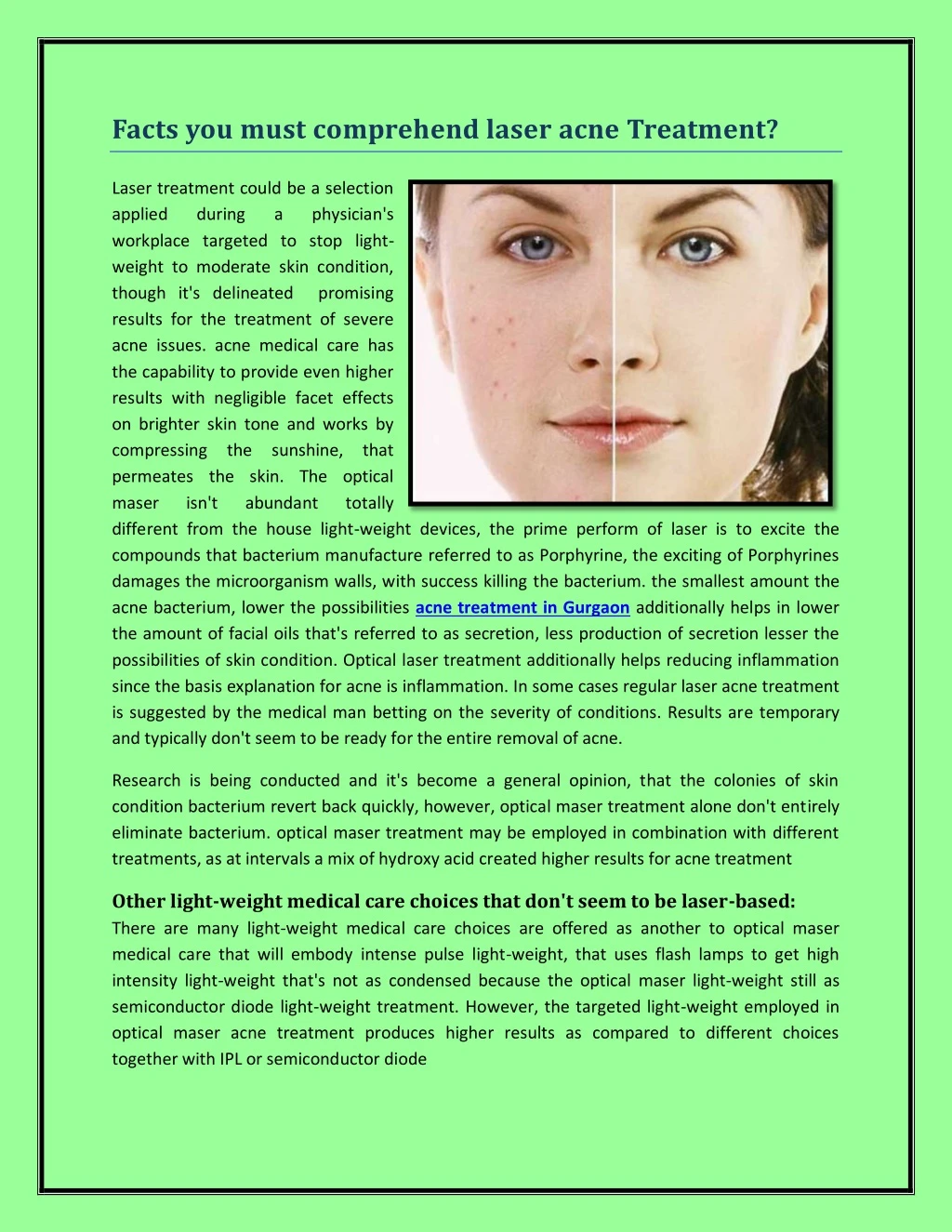facts you must comprehend laser acne treatment