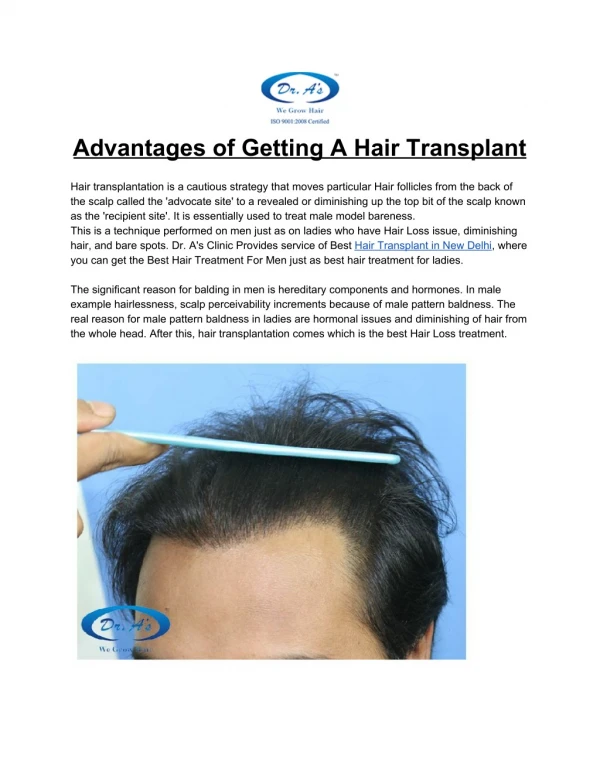 Advantages of Getting A Hair Transplant