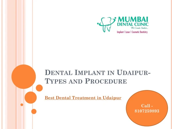 Dental Implant in Udaipur- Types and Procedure