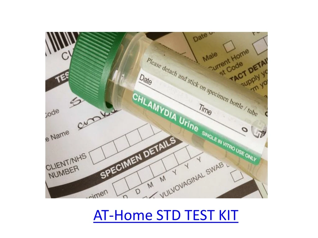 at home std test kit