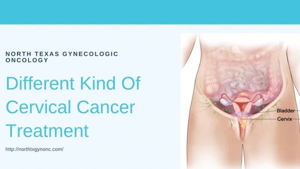 Different Kind Of Cervical Cancer Treatment