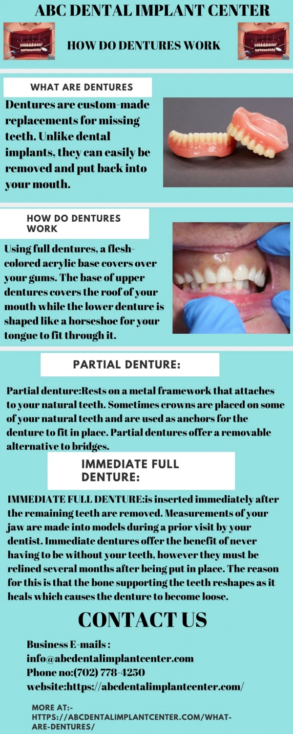 What are dentures?