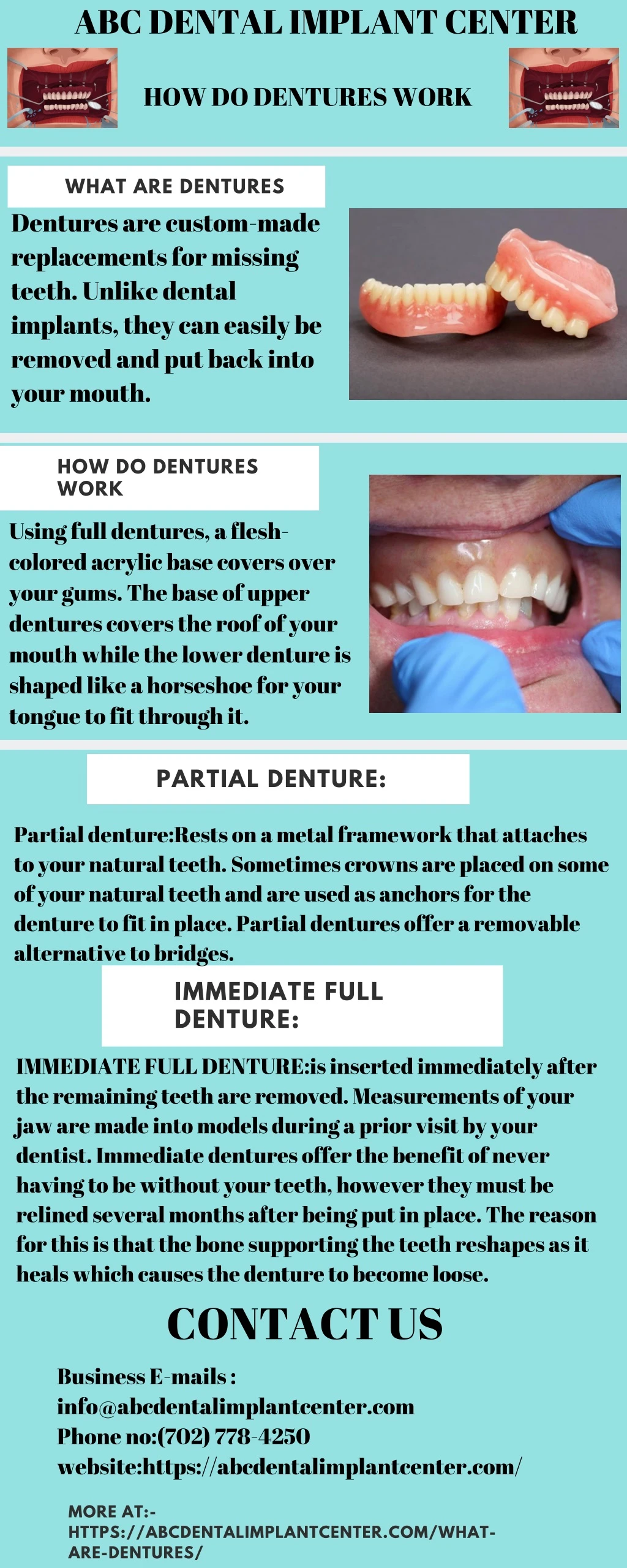 abc dental implant center