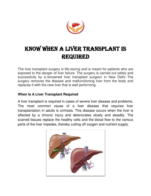 Know When A Liver Transplant Is Required
