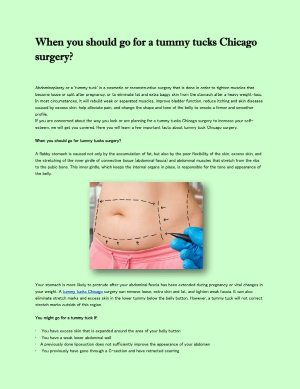 when you should go for a tummy tucks chicago when