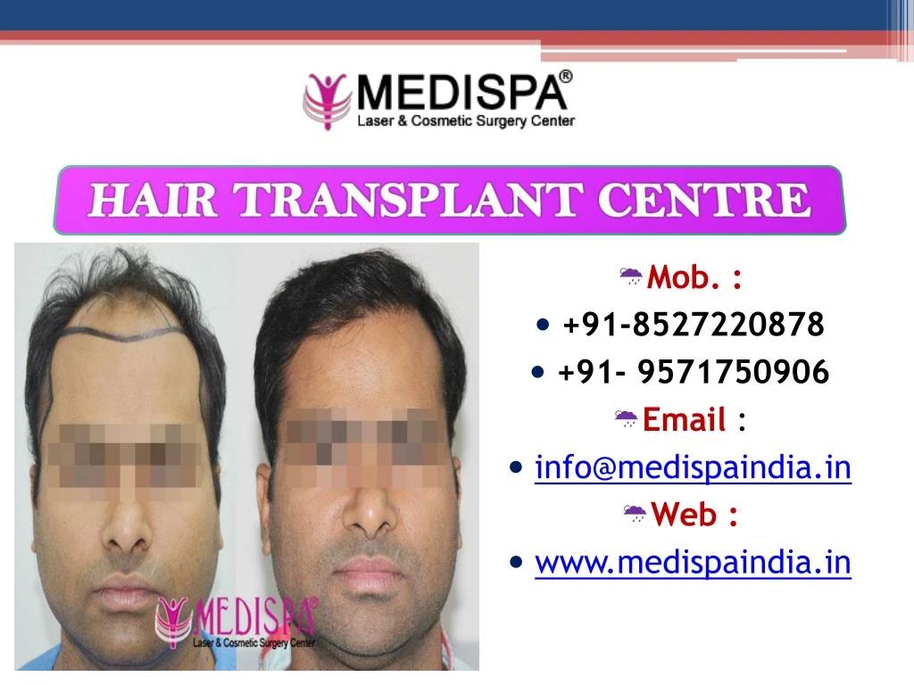 hair transplant centre