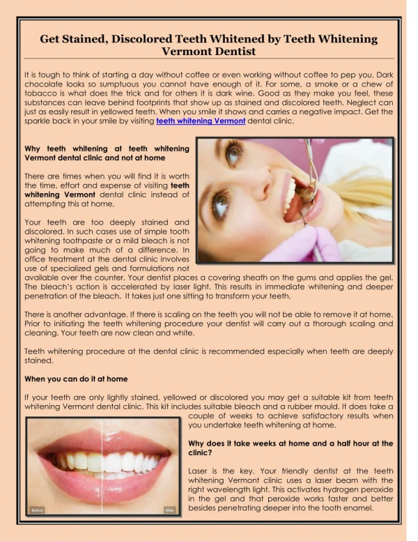 Get Stained, Discolored Teeth Whitened by Teeth Whitening Vermont Dentist
