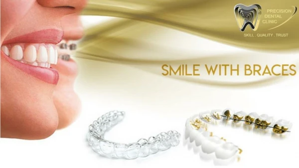 Best Orthodontist Clinic in Dubai