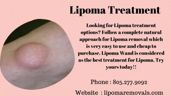 Lipoma Treatment Without Surgery - Lipoma Wand