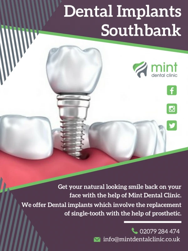 Dental Implants in Southbank