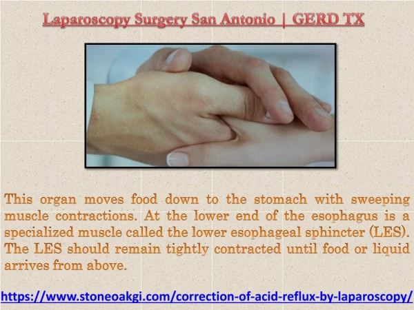 Laparoscopy Surgery San Antonio | GERD TX