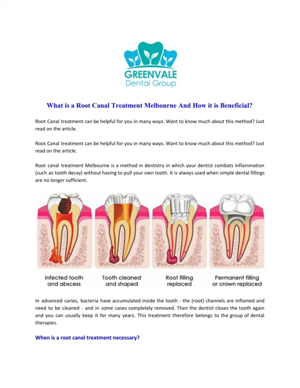 What is a Root Canal Treatment Melbourne And How it is Beneficial?