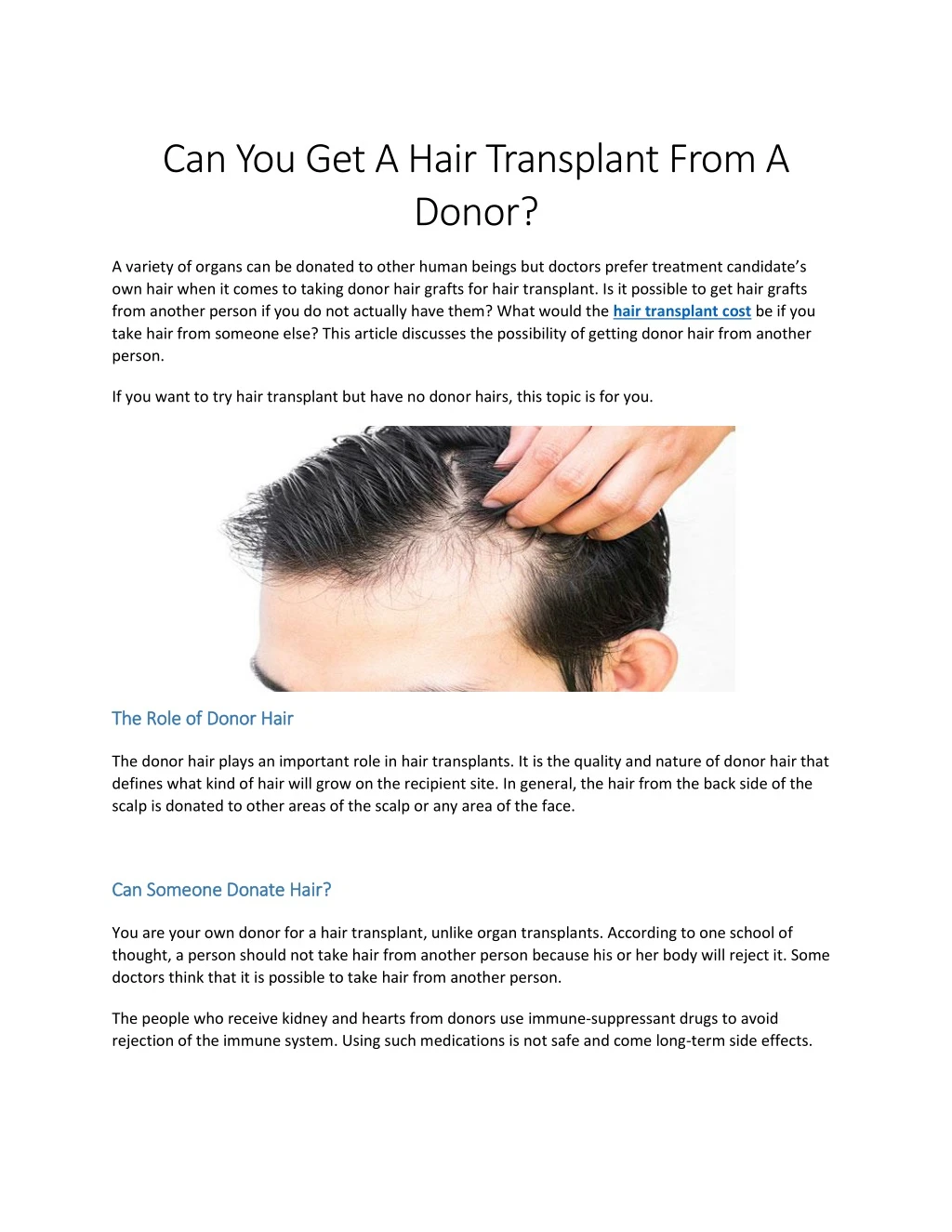 can you get a hair transplant from a donor
