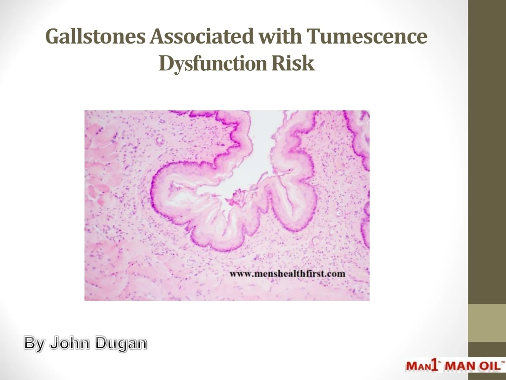 gallstones associated with tumescence dysfunction risk