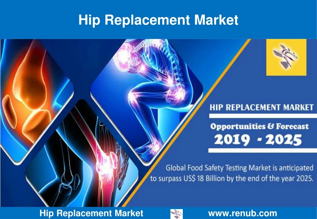 hip replacement market